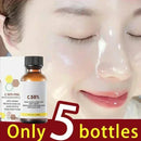 Face Care Exfoliating Radiant Skin Fade Dark Spots & Pigmentation for Even Brighter Skin Remove Spots Arm Knee Legs Melanin