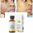 Face Care Exfoliating Radiant Skin Fade Dark Spots & Pigmentation for Even Brighter Skin Remove Spots Arm Knee Legs Melanin