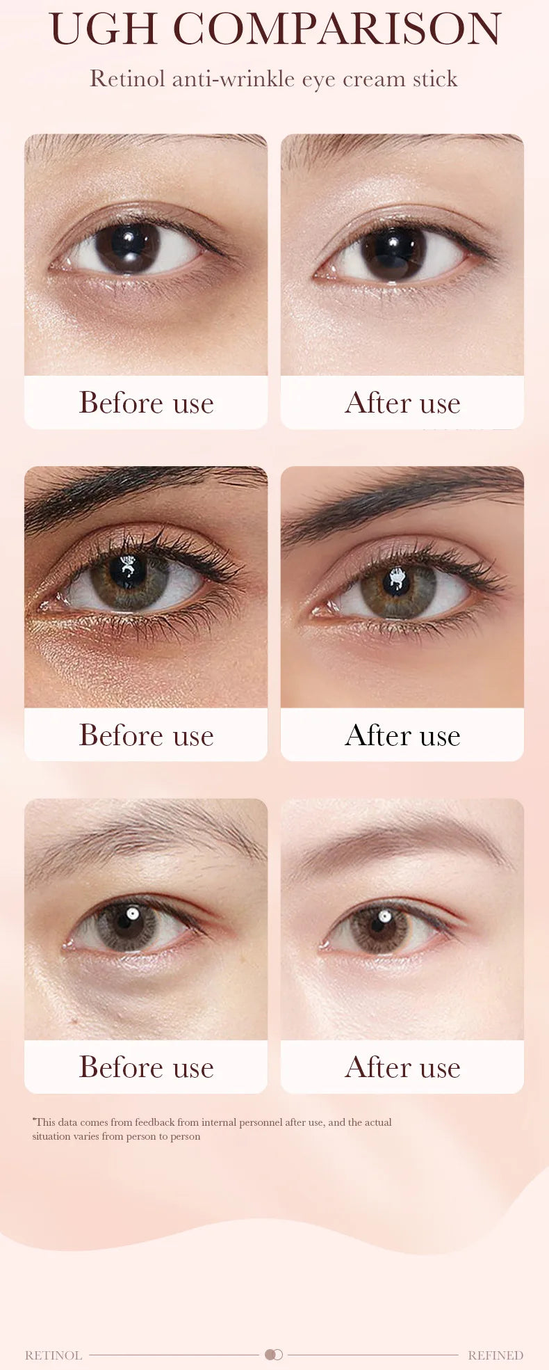 Bastão de Creme para Olhos com Retinol para Remover Olheiras
