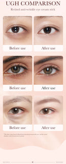Bastão de Creme para Olhos com Retinol para Remover Olheiras, Hidratar, Firmar e Iluminar a Pele ao Redor dos Olhos