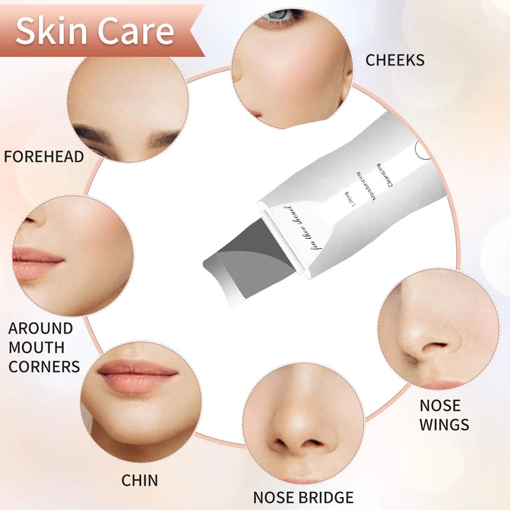 Raspador de pele ultrassônico Peeling Removedor de cravo Limpeza facial profunda Lifting Acne Pore Cleaner Espátula facial Limpador de pá