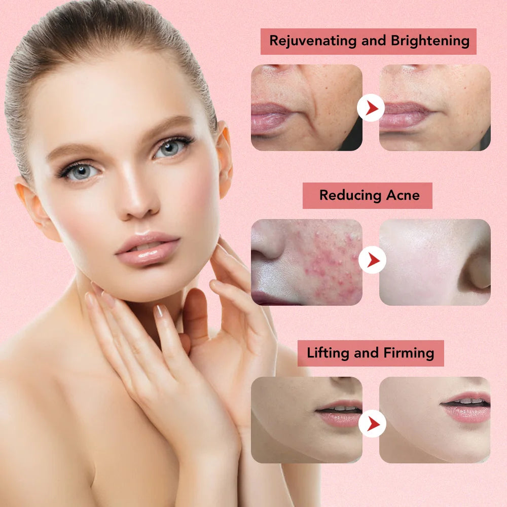 Massageador Facial RF EMS 7 em 1 Ferramentas de Cuidados