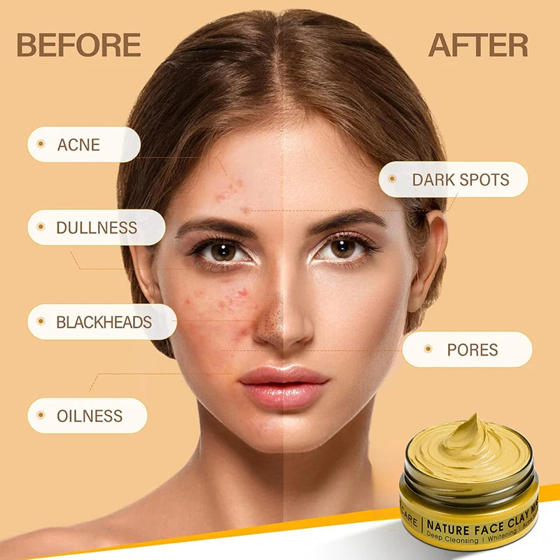 Máscara Facial de Argila com Cúrcuma e Vitamina C para Limpeza Profunda e Hidratação, Cuidados com a Pele, Máscara Facial para Remoção de Cravos e Limpeza de Poros