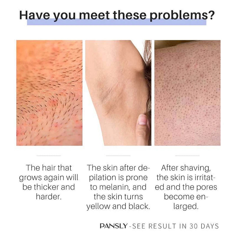 Inibidor de Remoção de Crescimento de Pelos Barba Biquíni Pernas Íntimas Corpo Axila Lotioína Suaviza a Pele e Cabelo Depilatório Indolor Permanante
