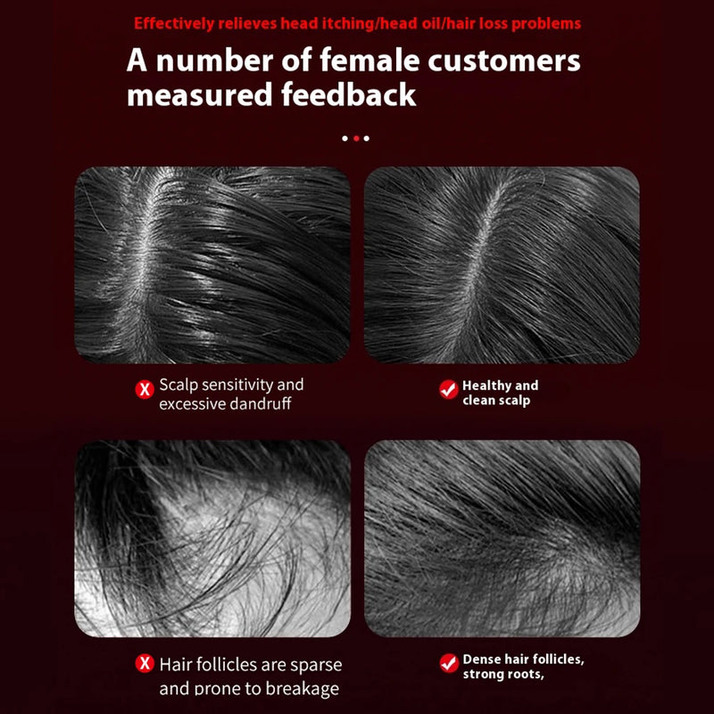 Escova de Cabelo com Luz Vermelha e Azul, Cuidados com o Cabelo, Massagem no Couro Cabeludo, Aplicador de Medicamento para o Couro Cabeludo 6/15ml, Sem Fio, Anti-Queda, Escova de Beleza