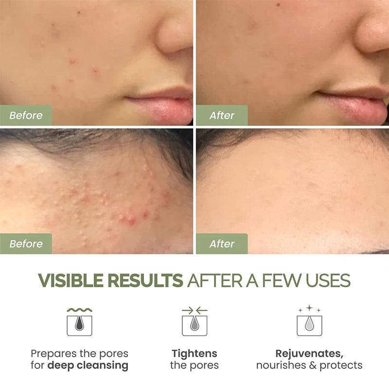 Máscara Facial de Argila com Cúrcuma e Vitamina C para Limpeza Profunda e Hidratação, Cuidados com a Pele, Máscara Facial para Remoção de Cravos e Limpeza de Poros