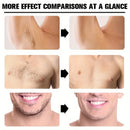 Creme Depilatório Permanente Creme Depilador Áreas Íntimas Saúde Indolor Removedor de Pêlos Inibidor de Crescimento para Mulher Homens Cuidados com o Corpo