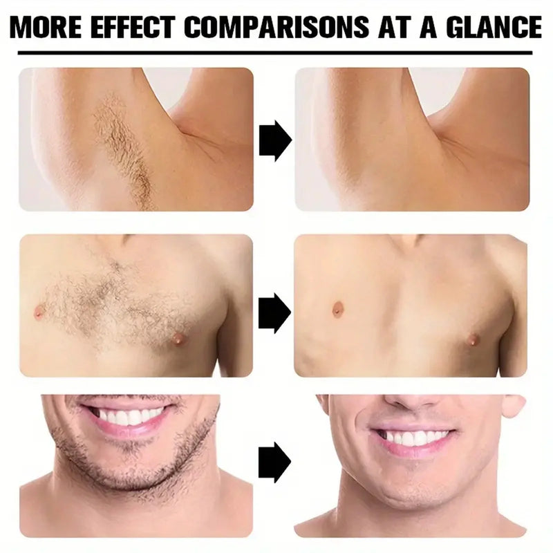 Creme Depilatório Permanente Creme Depilador Áreas Íntimas Saúde Indolor Removedor de Pêlos Inibidor de Crescimento para Mulher Homens Cuidados com o Corpo