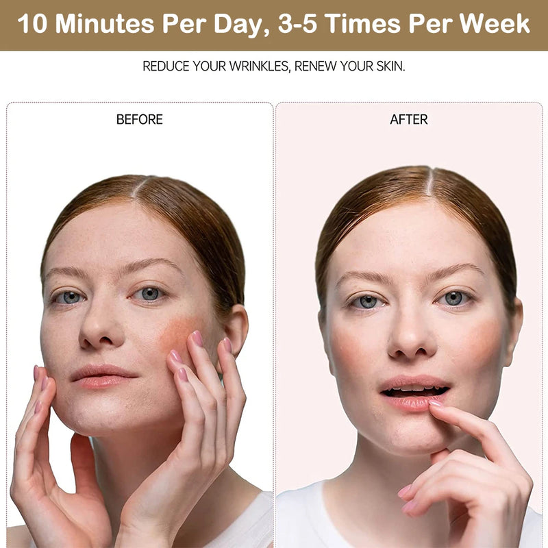 Dispositivo de Lifting Facial com Microcorrente EMS, Terapia de Luz LED, Reafirmação da Pele, Elevação Facial Elétrica, Vibrador e Massageador Facial Aquecido