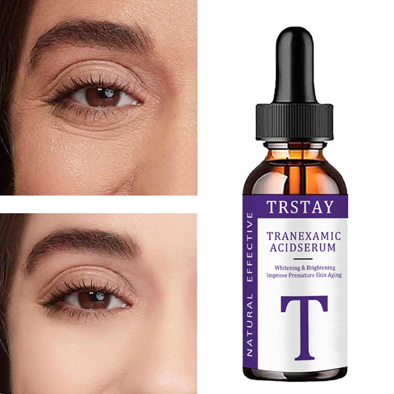 essência de ácido tranexâmico, suave e não irritante, hidratante, nutritiva, deixando a pele macia e delicada