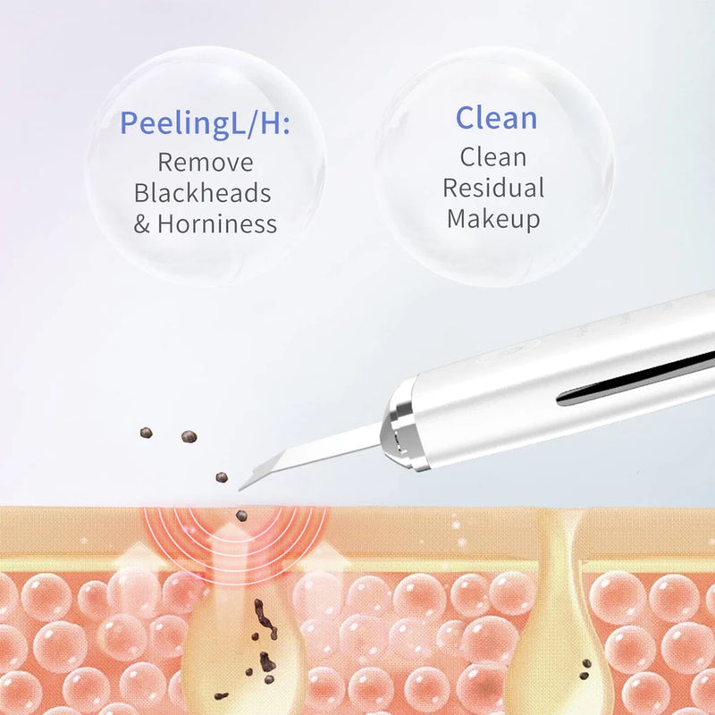 Raspador de pele ultrassônico Peeling Removedor de cravo Limpeza facial profunda Lifting Acne Pore Cleaner Espátula facial Limpador de pá