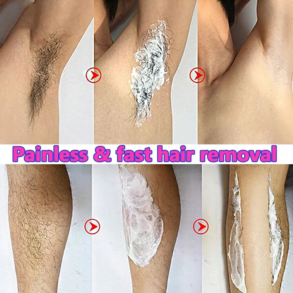Creme de Depilação Depiladora Permanente Creme Áreas Íntimas Saúde Indolor Removedor de Pêlos Inibidor de Crescimento para Homens Mulher Cuidados com o Corpo