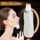 Raspador de pele ultrassônico Peeling Removedor de cravo Limpeza facial profunda Lifting Acne Pore Cleaner Espátula facial Limpador de pá
