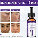 essência de ácido tranexâmico, suave e não irritante, hidratante, nutritiva, deixando a pele macia e delicada