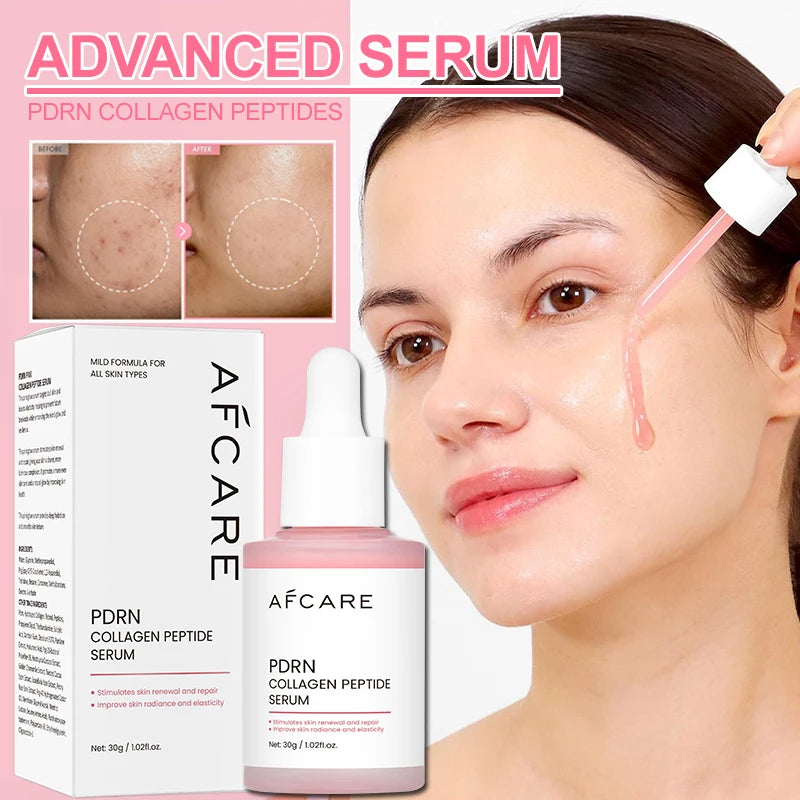 Sérum Antiacne de Peptídeo Complexo