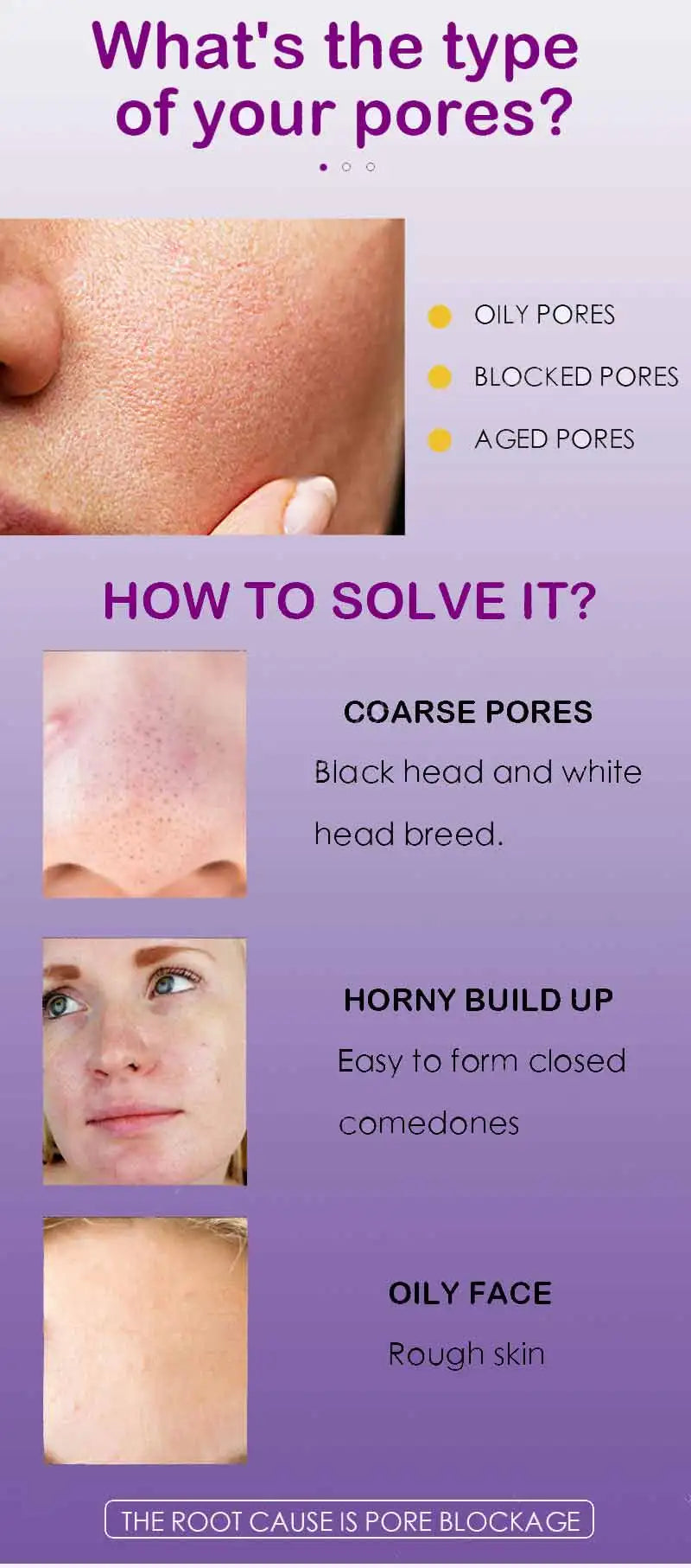 Poro Shrinking Serum Remoção de Rosto Grandes Poros Aperto Reparação Facial Poro Minimizando Essência Cuidados com a Pele Beleza Pele Firme