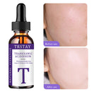 essência de ácido tranexâmico, suave e não irritante, hidratante, nutritiva, deixando a pele macia e delicada