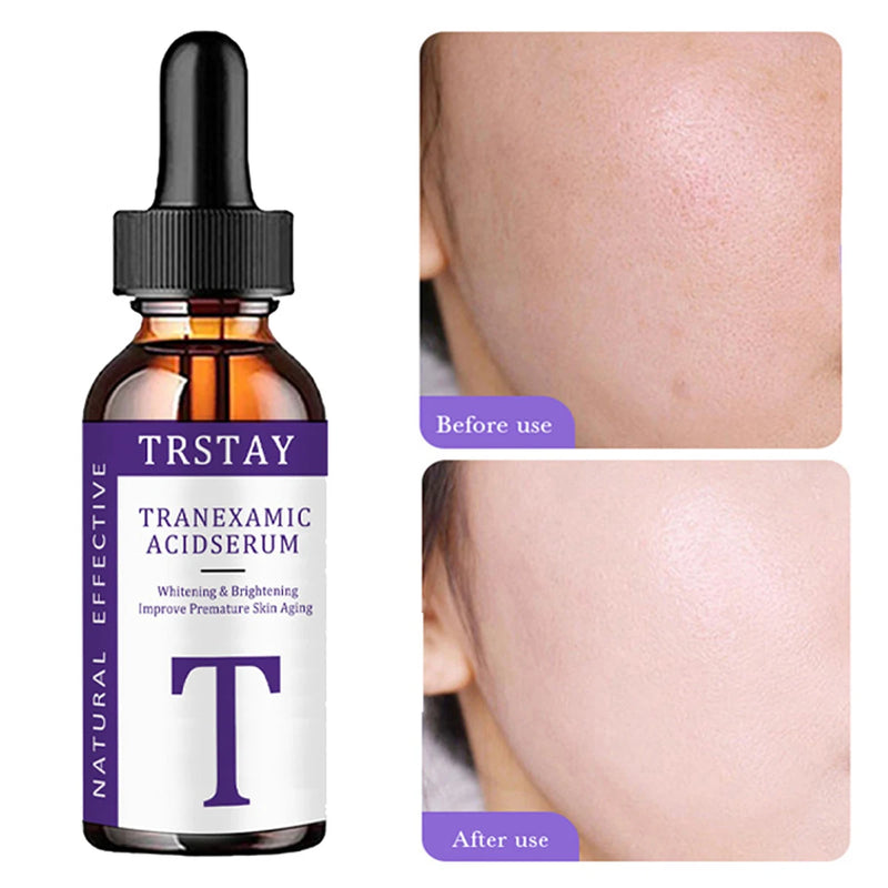 essência de ácido tranexâmico, suave e não irritante, hidratante, nutritiva, deixando a pele macia e delicada