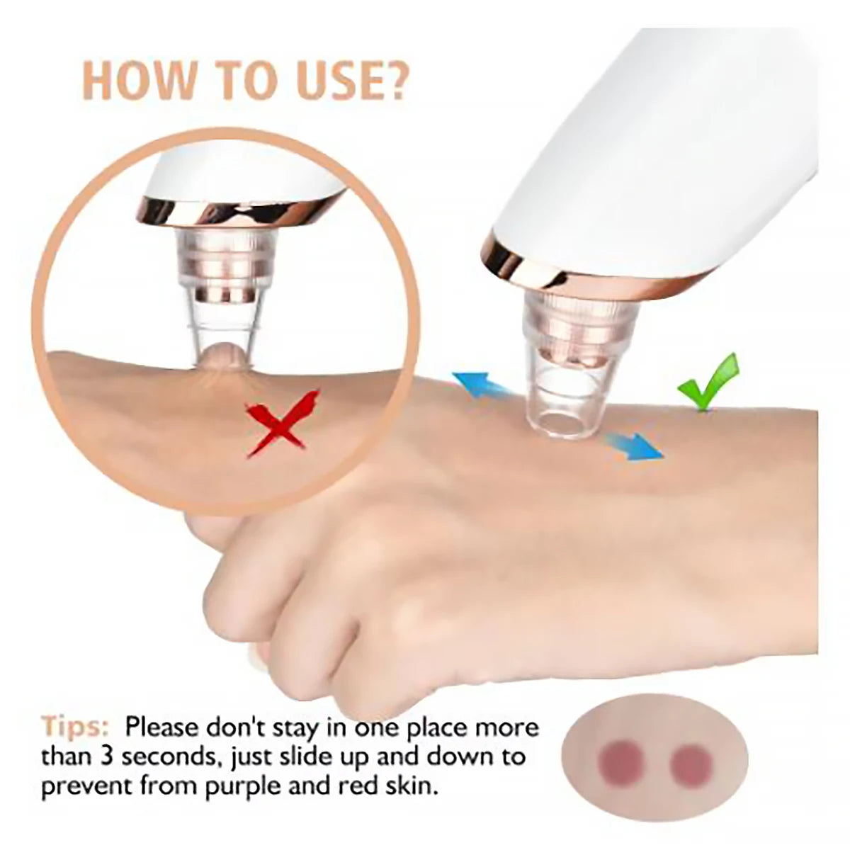 Removedor de Cravos Aspirador de Poros Limpador de Rosto Elétrico Remoção de Espinhas e Acne Remoção de Cravos USB Recarregável Ciclo de Água
