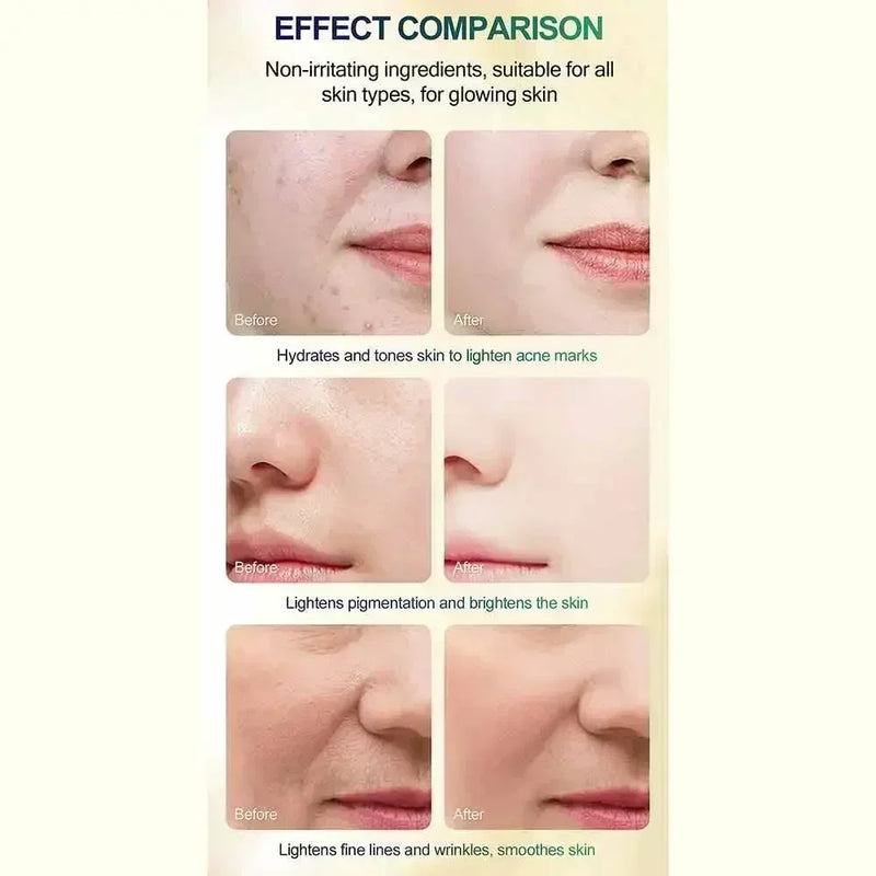 Face Care Exfoliating Radiant Skin Fade Dark Spots & Pigmentation for Even Brighter Skin Remove Spots Arm Knee Legs Melanin