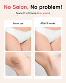 IPL Depilação Laser 22J IGBT Ilimitado 5,2 cm² luz Flashes Rápidos Depilador Indolor Rosto Axila Biquíni Treament para homens mulheres