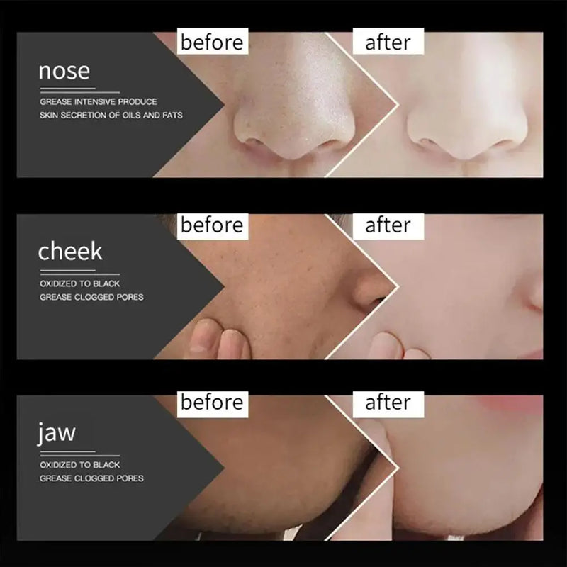 Máscara Facial de Lama com Carvão Vegetal de Bambu 60g, Carbono Ativo, Limpeza Profunda, Purificante, Remove Cravos, Removedor de Cravos de Morango