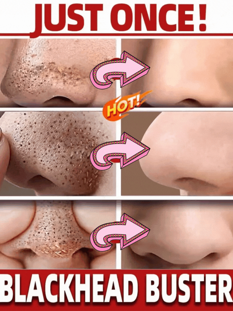 Máscara de Lama Removedora de Cravos com Chá Verde, Bastão de Limpeza Facial, Combate Espinhas e Manchas, Reduz Poros, Controle de Oleosidade, Esfolia e Clareia a Pele