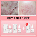 Sérum Antiacne de Peptídeo Complexo PDRN Colágeno Reduz Poros Clareia Melanina Suaviza e Ilumina a Pele Produtos Coreanos de Skincare