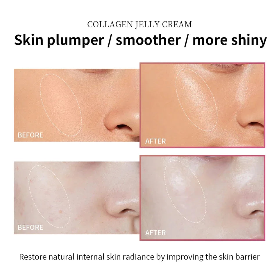 Creme Gel de Colágeno com Niacinamida para Rosto 100ml - Efeito Firmador, Calmante, Hidratante, Anti-idade