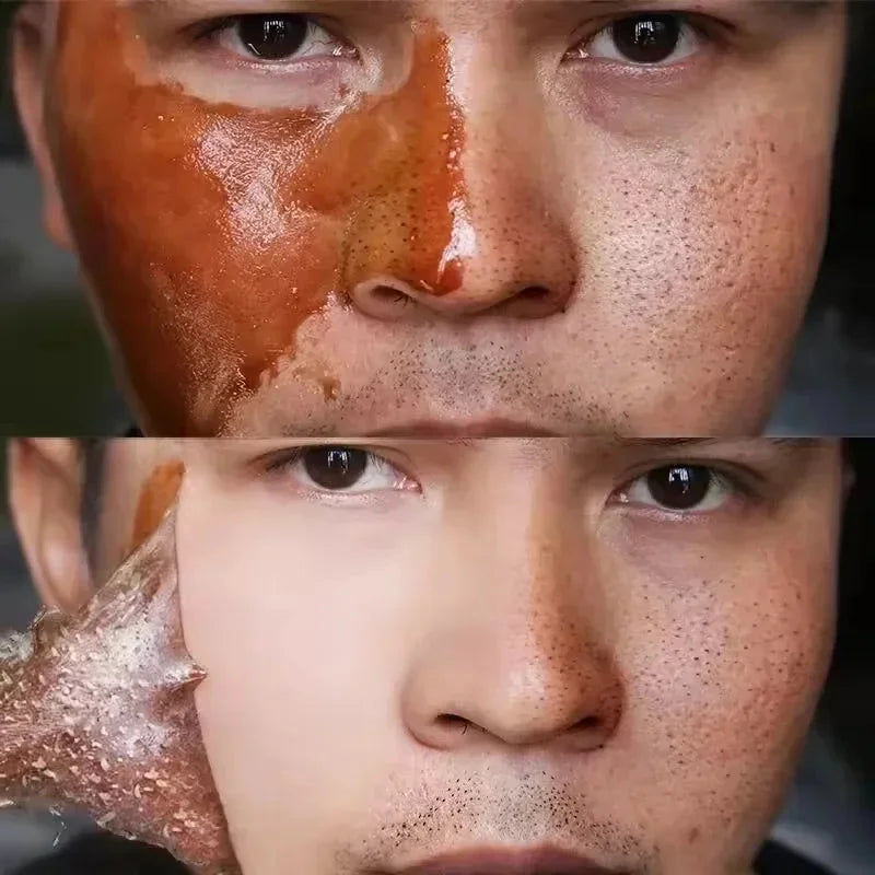 Máscara de Ouro 24k Peel Off para Remoção Instantânea de Sardas
