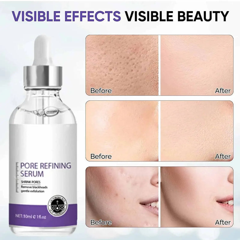 Poro Shrinking Serum Remoção de Rosto Grandes Poros Aperto Reparação Facial Poro Minimizando Essência Cuidados com a Pele Beleza Pele Firme