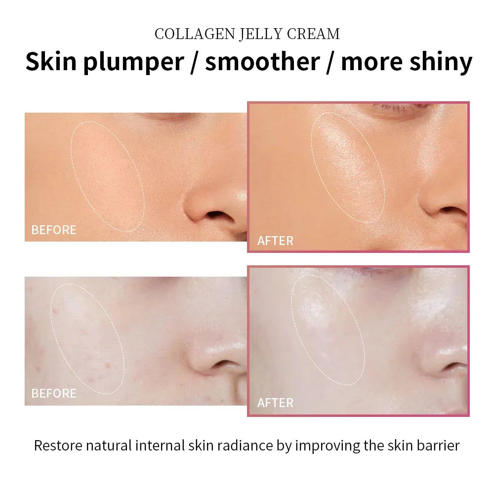 Creme Gel de Colágeno com Niacinamida para Rosto 100ml - Efeito Firmador, Calmante, Hidratante, Anti-idade