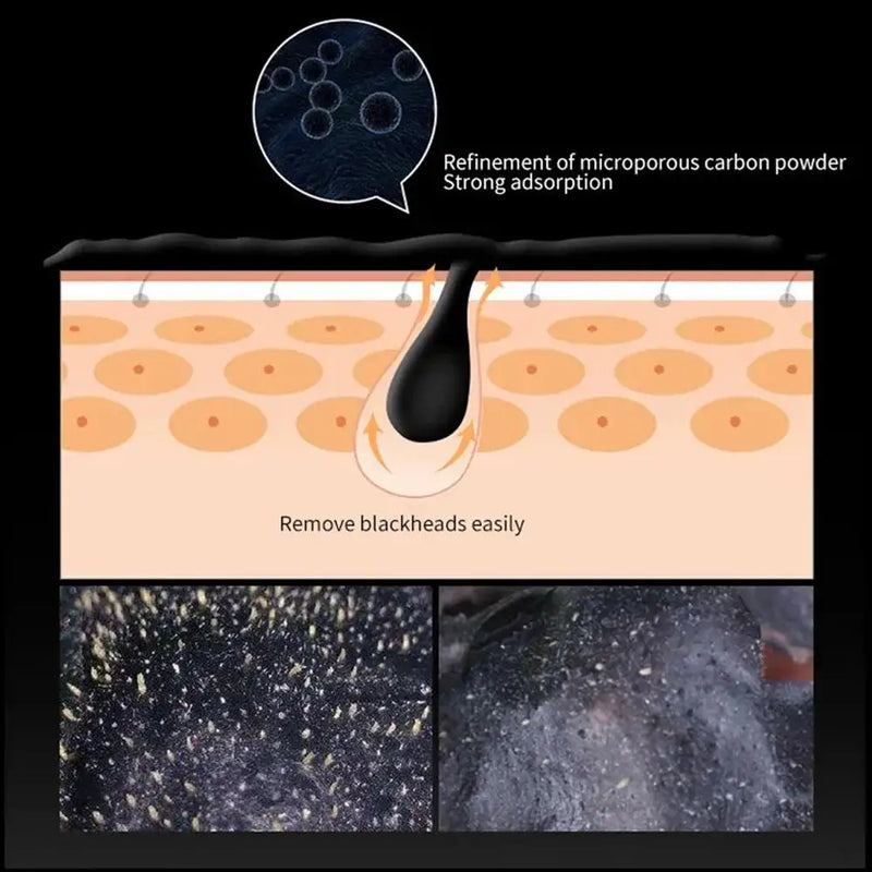Máscara Facial de Lama com Carvão Vegetal de Bambu 60g, Carbono Ativo, Limpeza Profunda, Purificante, Remove Cravos, Removedor de Cravos de Morango