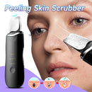 Raspador de pele ultrassônico Peeling Removedor de cravo Limpeza facial profunda Lifting Acne Pore Cleaner Espátula facial Limpador de pá