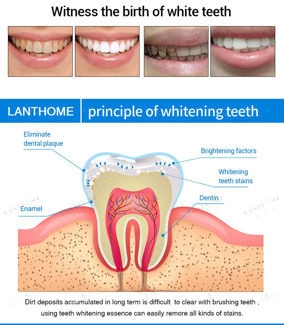 Caneta de clareamento dental Reparação Remover placa de melanina amarela 7 dias Limpeza rápida dos dentes Ferramentas de tratamento de dentes Placa de beleza Saúde