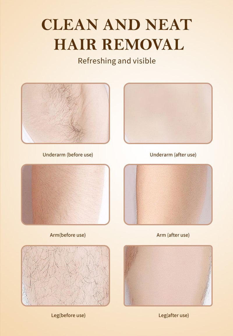 Epilador Elétrico para Remoção de Pelos para Mulheres, Cortador de Pelos, Depilador, Para Virilha, Axilas, Braços, Pernas, Rosto e Partes Íntimas, Lâmina para Mulheres